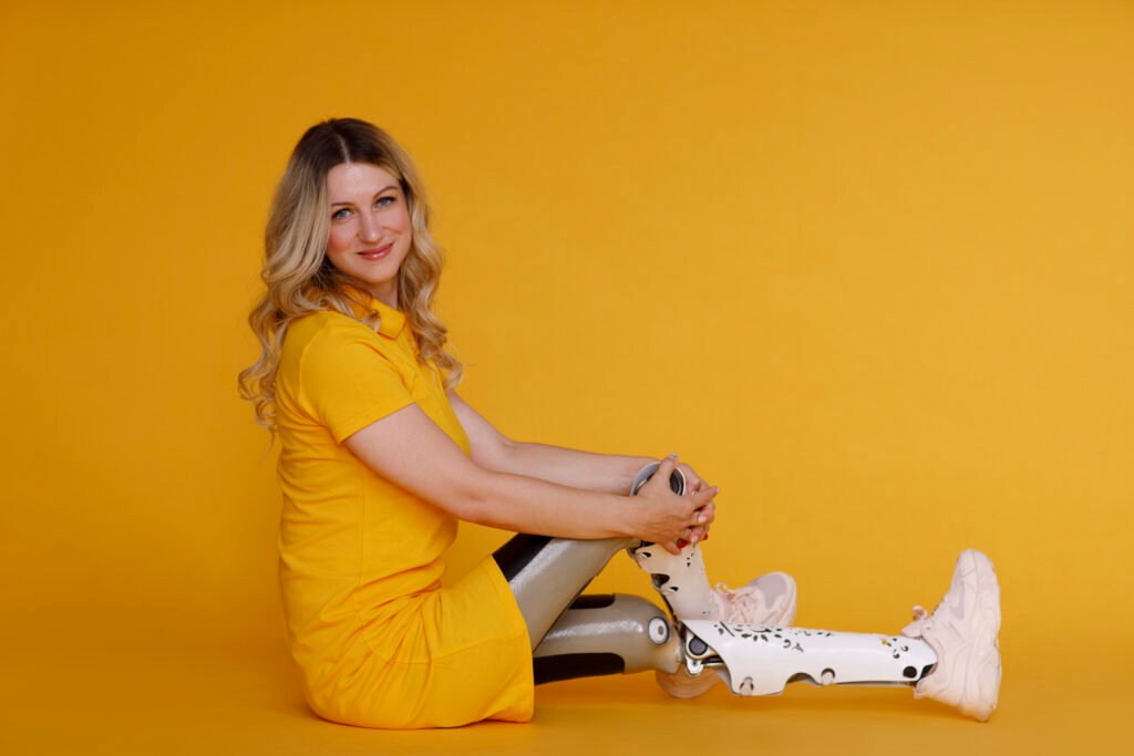 Top 5 beneficios de tener una pierna biónica de última generación